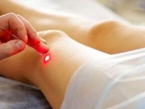 Léčba artrózy kolenního kloubu laserem